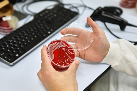 Sample tray with red liquid inside it. Being held by person with blue gloves on.